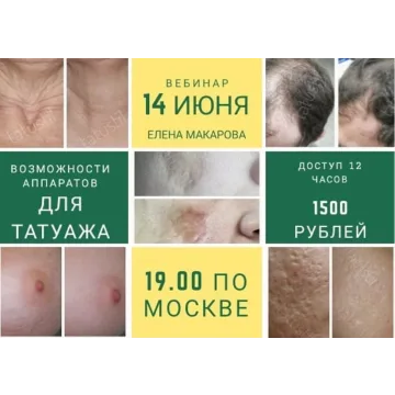 Возможности аппаратов для татуажа. Июнь, 2019 (Елена Макарова)