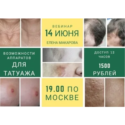 Возможности аппаратов для татуажа. Июнь, 2019 (Елена Макарова)
