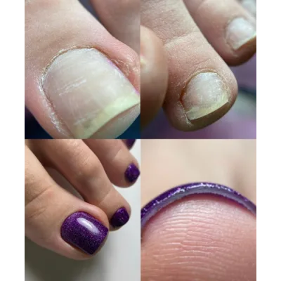 Культура педикюра. Эстетика. Тариф «Без обратной связи» (Анна Романова)