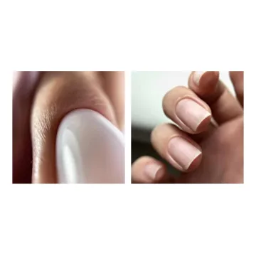 Комбинированный маникюр (Валентина Воронина)